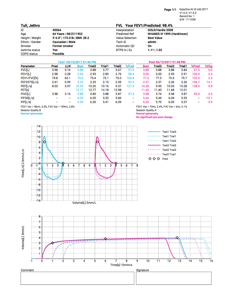 EasyOne Air Spirometer ndd New MME